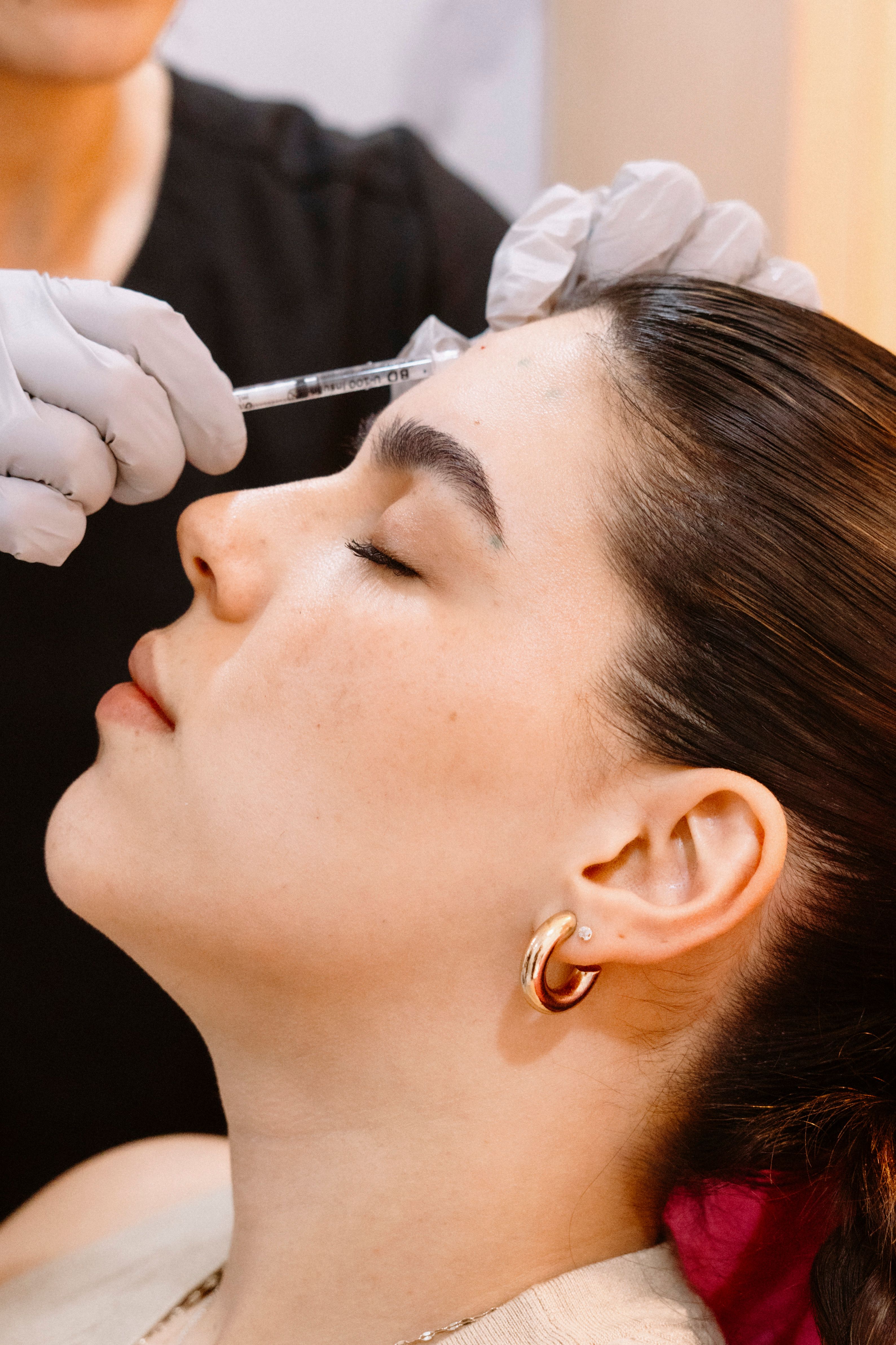 Dermal Fillers in Seoul: 2026 Price, Korean vs Imported Brands & Areas - Wellisia