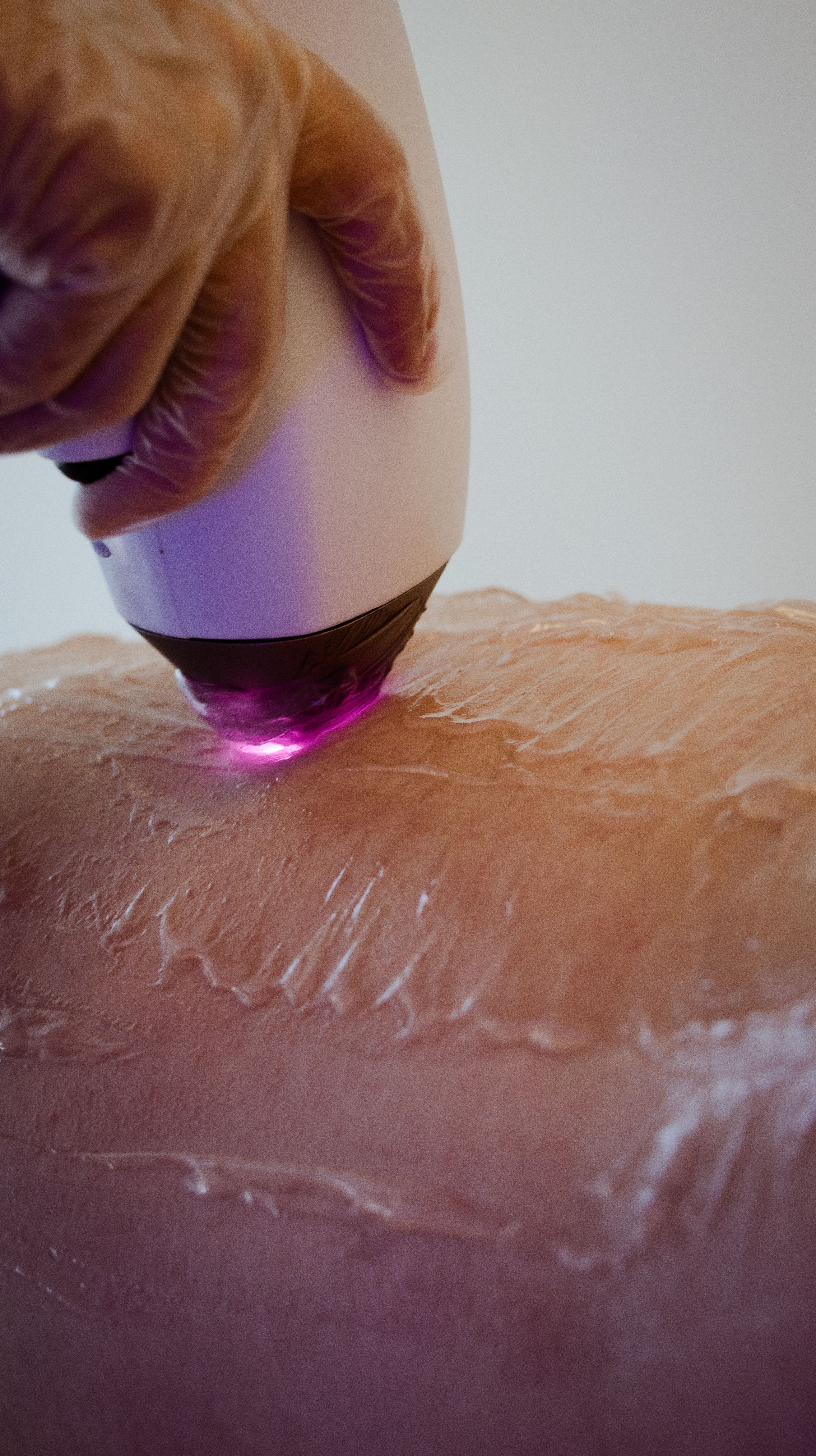 Thermage in Seoul for Foreigners: 2026 Price & Treatment Guide - Wellisia
